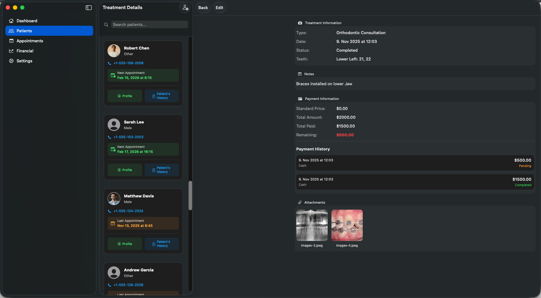 Treatment tracking with interactive tooth chart and procedure details in Dentail