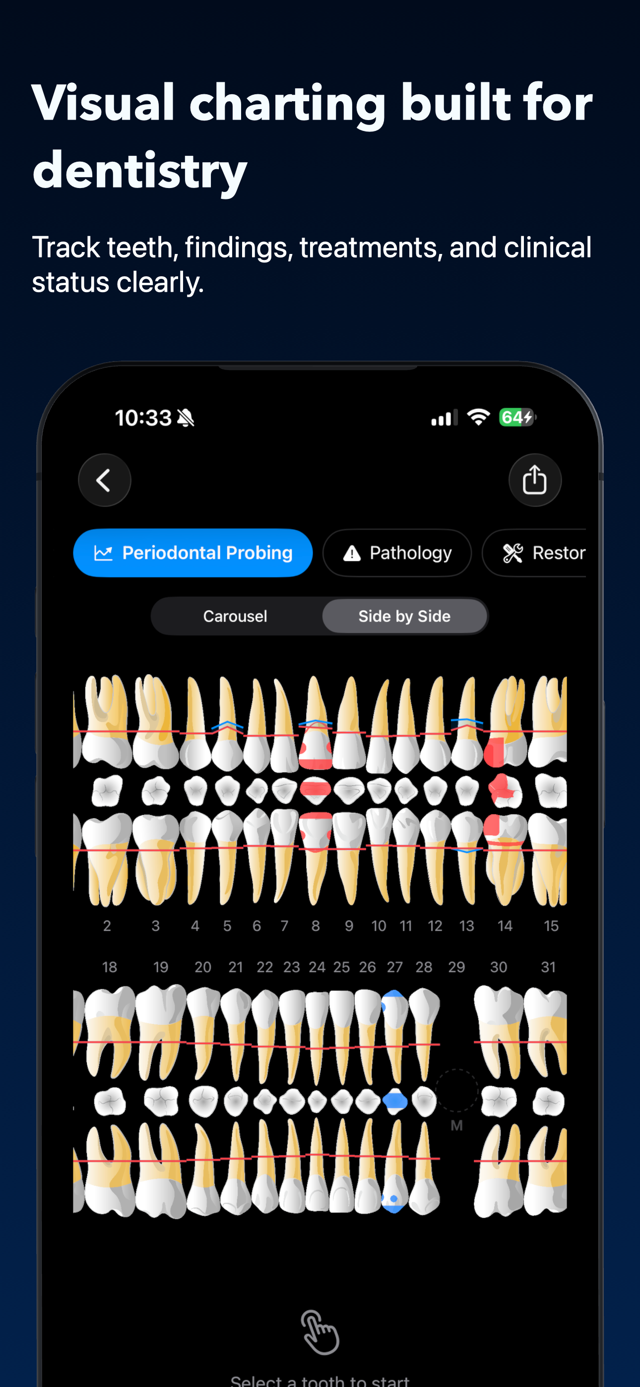Visual dental chart on iPhone